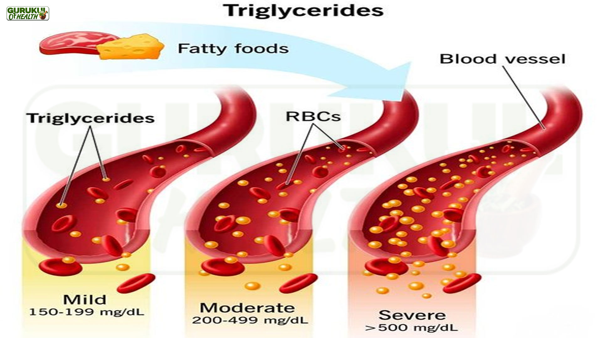 क्या आप ट्राइग्लिसराइड्स (Triglycerides) की सच्चाई जानते हैं?