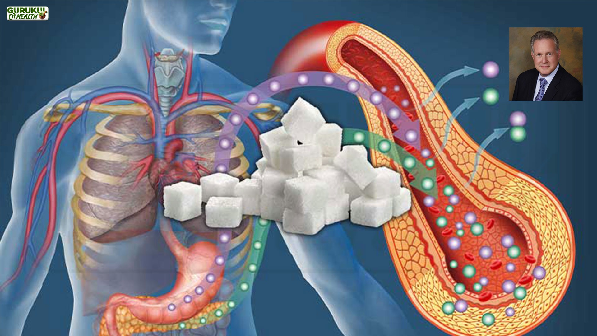 Obesity का असली कारण: कैलोरी नहीं, Insulin है
