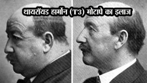 थायरॉयड हार्मोन (T3): मोटापे का इलाज?
