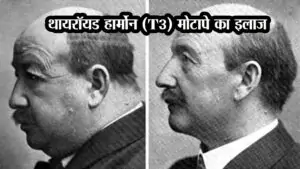 थायरॉयड हार्मोन (T3): मोटापे का इलाज?