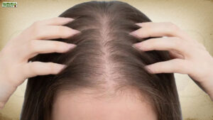 Hair Loss in Women: प्रकृति के इशारों को समझें और समय पर कदम उठाएं