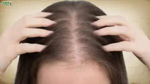 Hair Loss in Women: प्रकृति के इशारों को समझें और समय पर कदम उठाएं