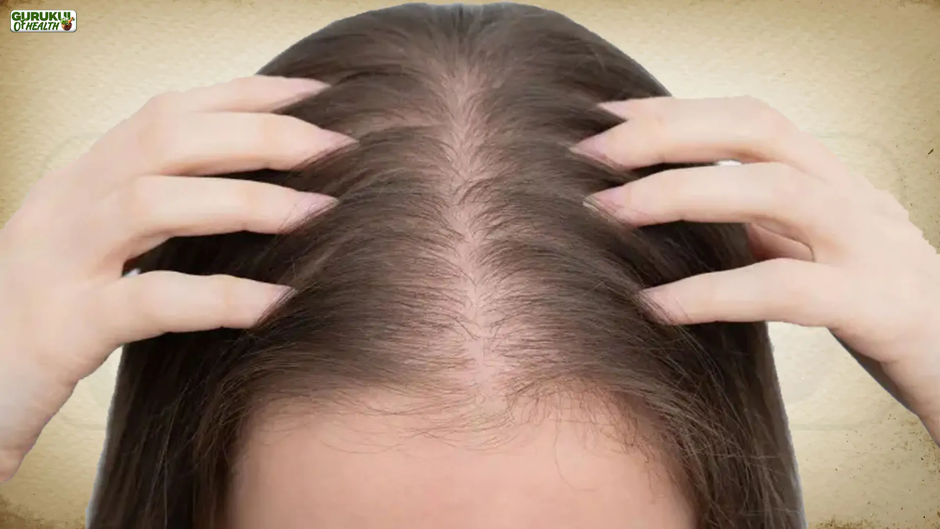 Hair Loss in Women: प्रकृति के इशारों को समझें और समय पर कदम उठाएं